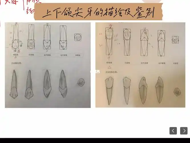 16615上下颌尖牙的区别:1,上颌尖牙体积较大,牙冠宽大,下颌尖牙
