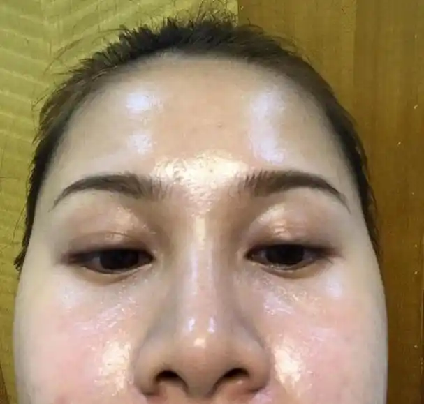 油性皮肤隐藏的好处:耐老耐晒,不易长皱纹,过敏,干皮羡慕不来