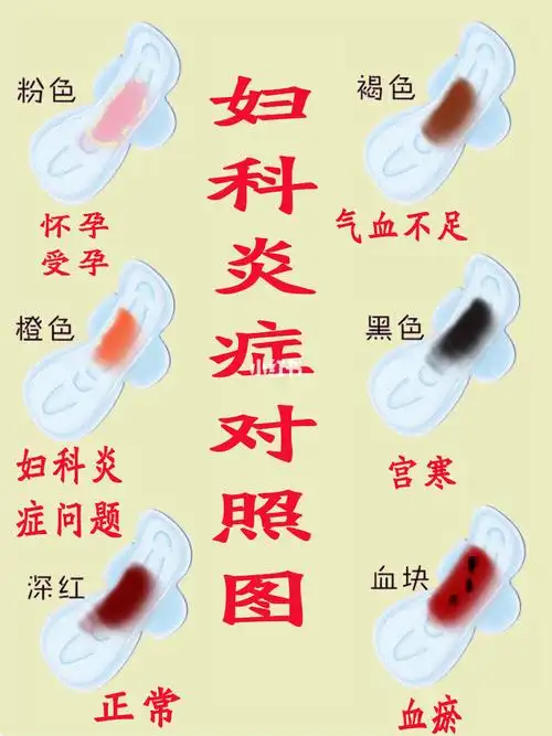 妇科炎症对照表,一定要看看啊_妇科炎症_洗液_妇科_清洁_私处_炎症