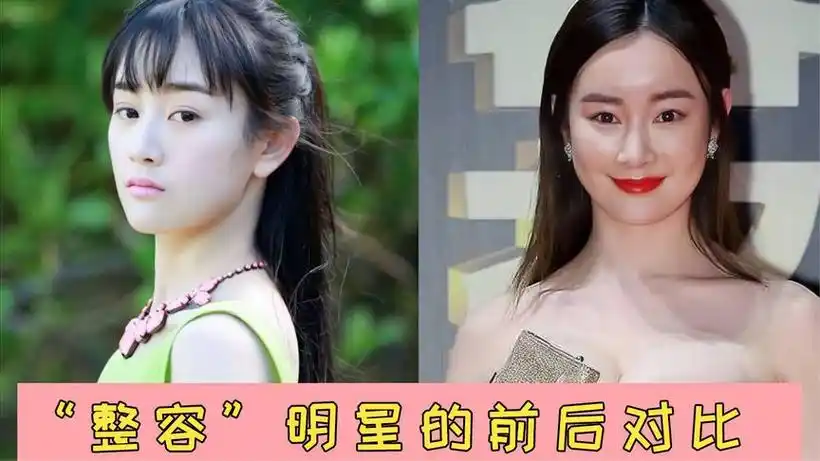 明星整容前和整容后
