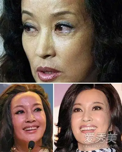 赵丽颖李小璐皮肤差 盘点15位素颜最丑的女明星