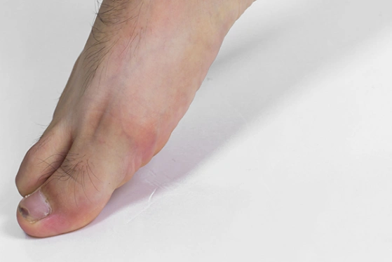 踮脚尖有什么好处