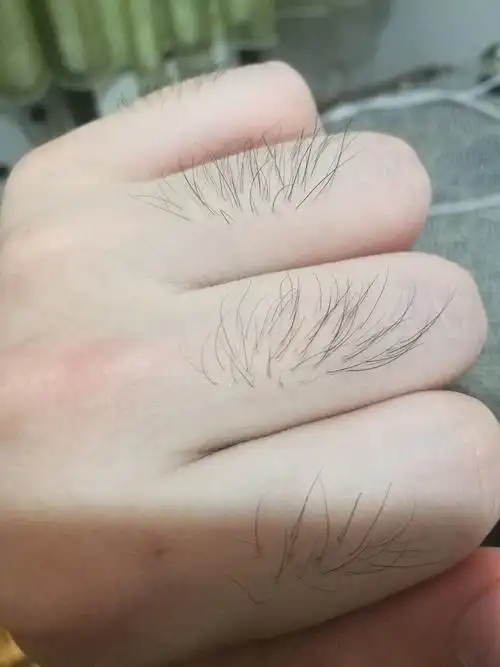 手指上长毛是一种什么样的体验