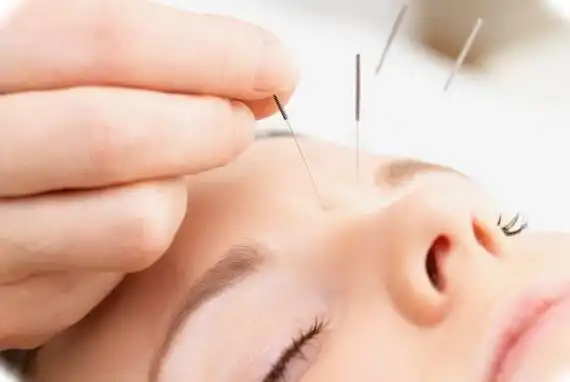 healing chi针灸中心