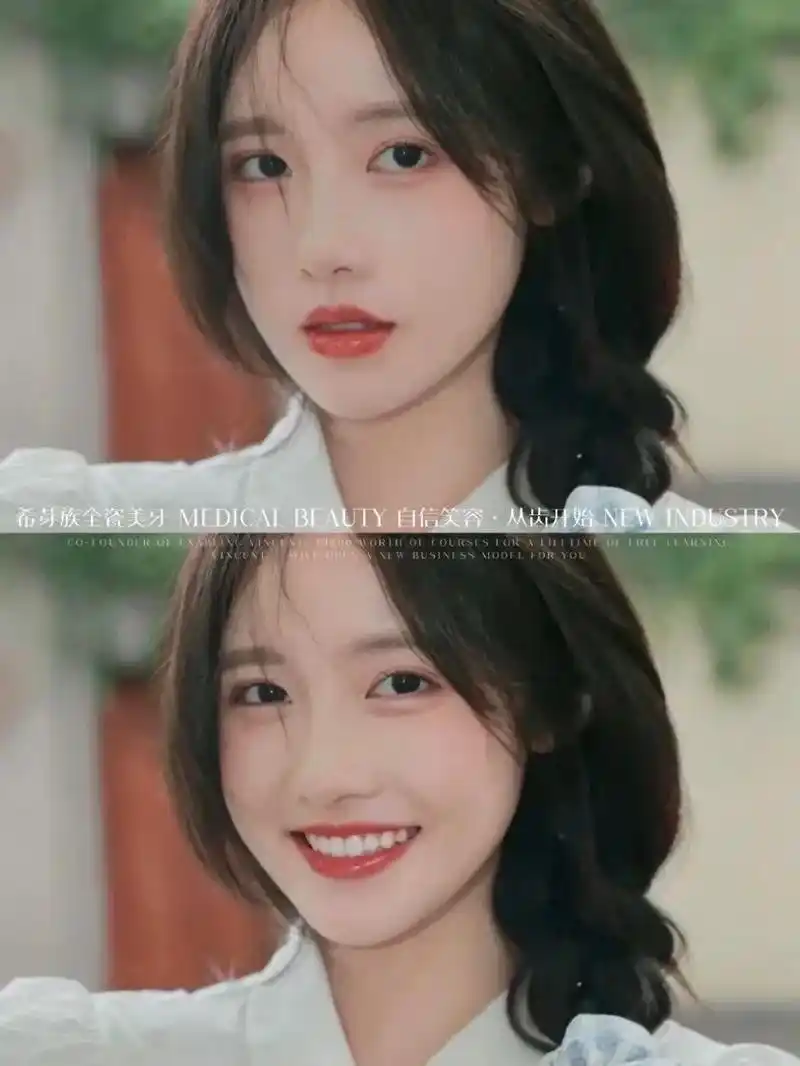 今天你露齿笑了吗? 感受笑容的魅力～ #就要露齿笑#治愈系笑 - 抖音