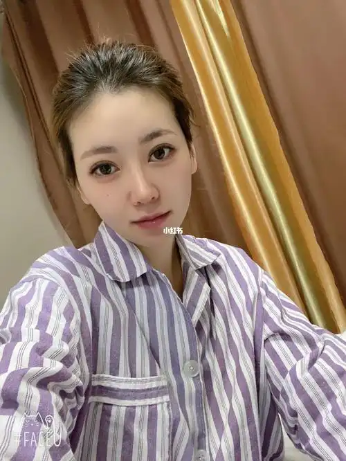 全脸脂肪胶填充对比图