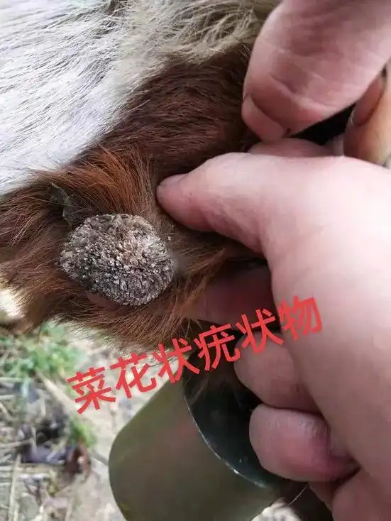 我也是头一次见这么大的菜花疣,一般都在口腔或者生殖器周围.# - 抖音