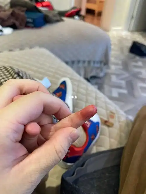 三岁小朋友被刀割伤了要打破伤风针吗?