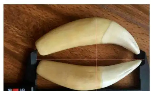 成年的老虎牙骨壁相当凸出,骨质丰满,整颗牙不会有凹凹凸凸的地方