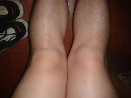 膝盖那个地方的骨头有点弯