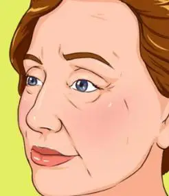 皮肤容易松弛的原因3