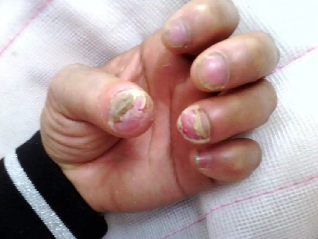 有谁见过此病例