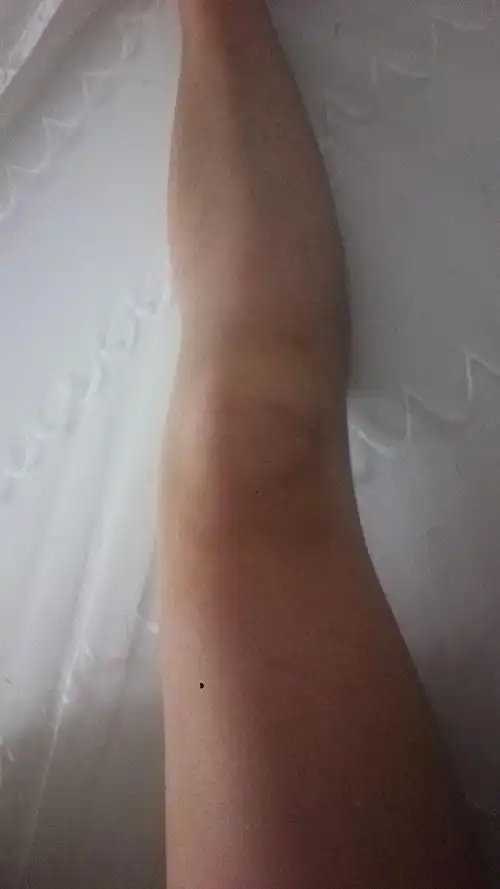 追问 因为是从膝盖下面开始有点弯 穿长裤什么的难看