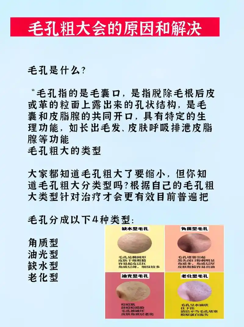 毛孔粗大的类型和解决方法.