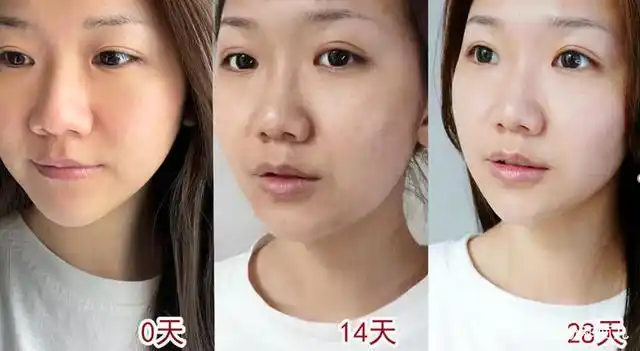 晒了一夏天,你该美白啦!烟酰胺美白效果怎么样?