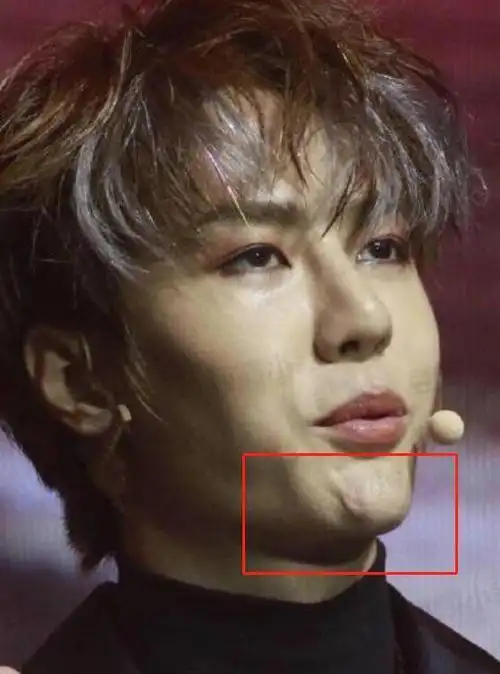 王一博火了之后,整容这个词,就没离开过他耳朵.