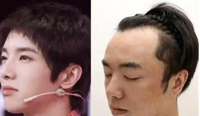 不要再说植发效果不好了华晨宇这么好的植发效果你还不认同吗