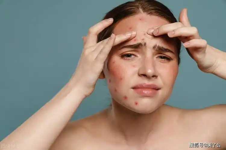 皮脂腺_油脂_皮肤