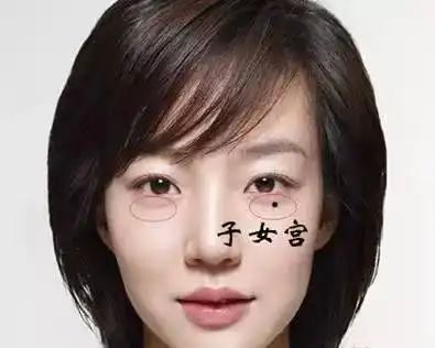 身上有这3处痣,一生劳碌难享福,命苦啊!