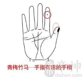 女性左手食指有痣好不好 手指痣相解析