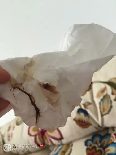 这是在家躺了第二天了还有这种黑褐色物质,前天下午一发现有血就去