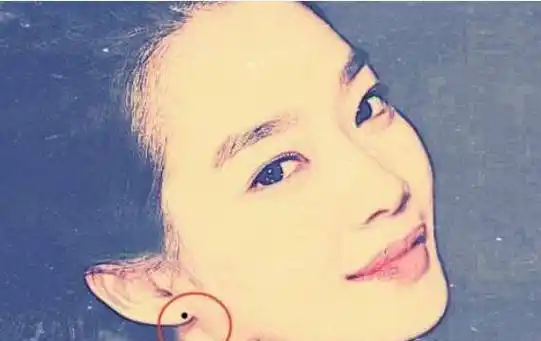 身上这4处的痣是"发财痣",得一颗财源滚滚,一生不会缺钱!