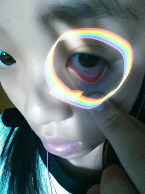 眼皮里面不同颜色,怎么回事.