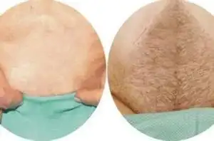 女性3生长阶段生长的年龄疾病问题青春期总体介绍2生理周期1生理作用