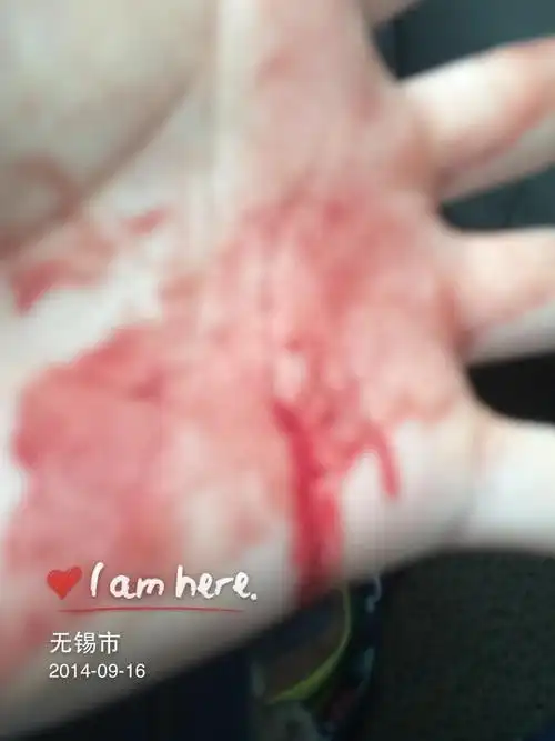 我大学室友被他父亲砍了一刀流血了,私人物品电脑音响什么的也被砸了