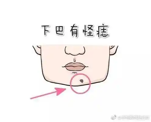 气运有这几颗痣的人早年艰辛35岁之后财气势不可挡