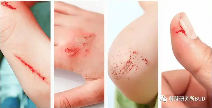 种草家有好动娃创可贴伤口护理套装囤起来