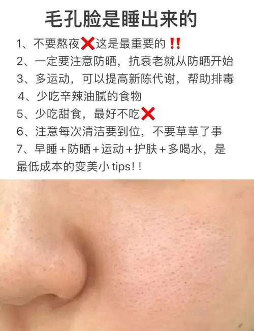 毛孔粗大?4步教你轻松缩小毛孔!