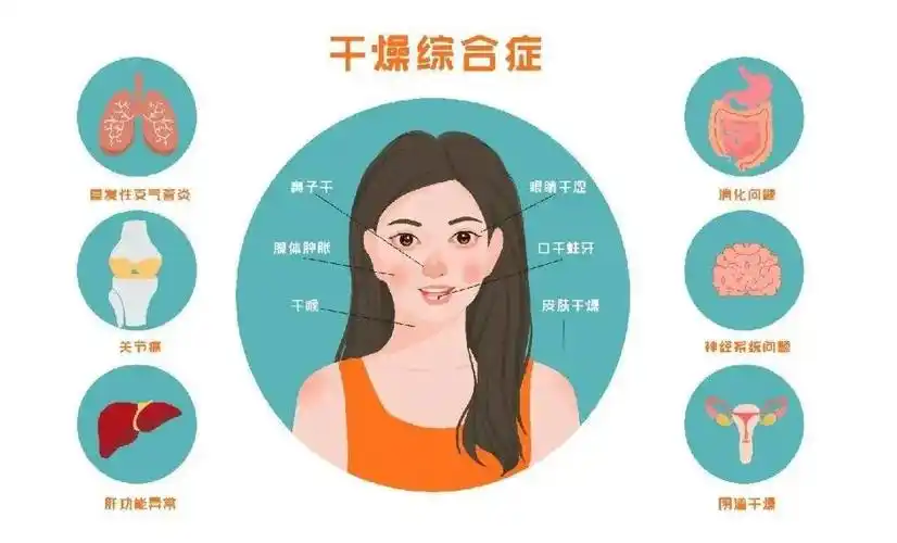 当心干燥综合征!_健康频道_新闻中心_长江网_cjn.cn