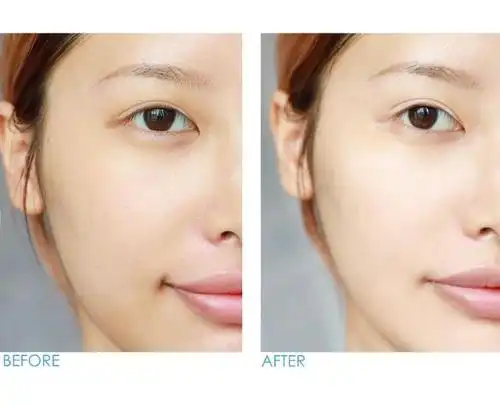 安瓶的作用超全解析,如何美白皮肤就靠它!想美白的姐妹切勿错过