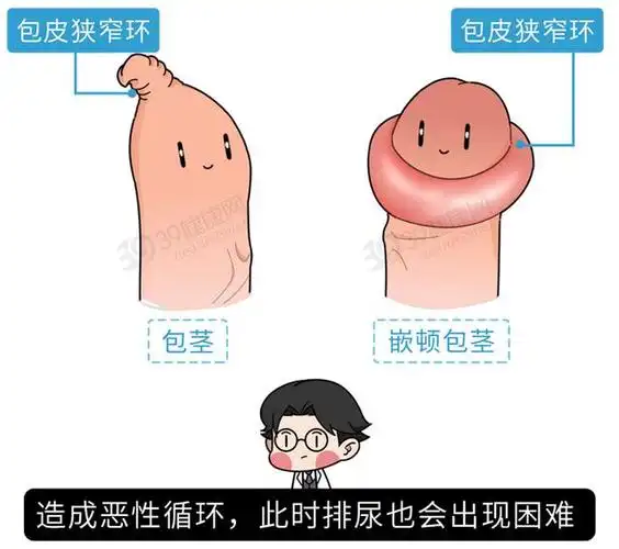 一般病程超过24小时这就很可能导致水肿组织的表皮因摩擦破损引起继发