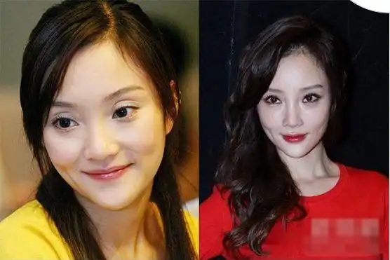 曾经整容失败过的明星:李小璐