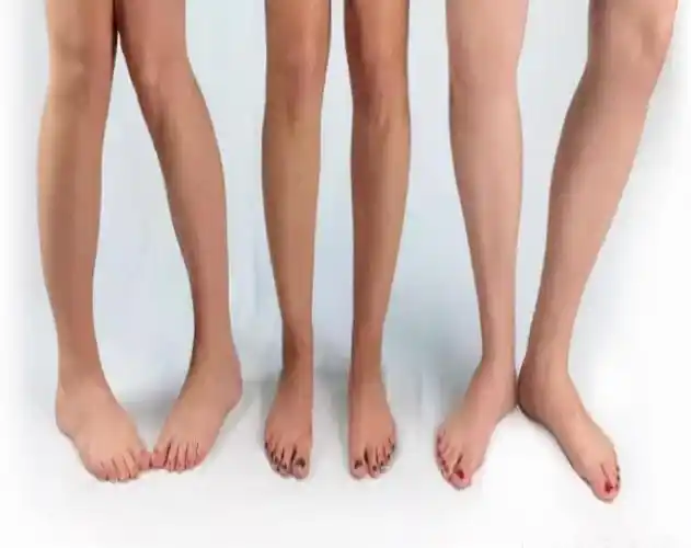 宝宝脚内八字(孩子走路"内八字",需要纠正吗?)_达一风水网