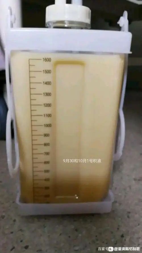 磨玻璃结节微浸润腺癌手术后发生乳糜胸怎么办?