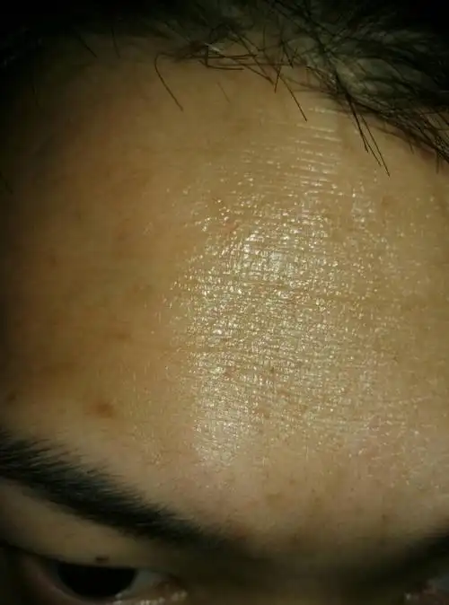 感觉自己的皮肤不好,这是什么问题?