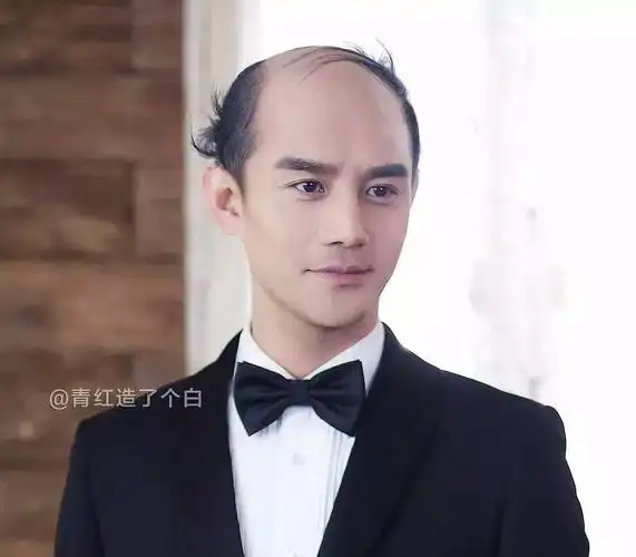 当红流量男明星秃顶了,你还爱他们吗最考验男星颜值的不是光头,是秃头