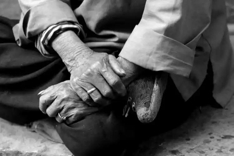 最后的小尖脚20056山西泽州裹脚也称缠足是中国古代的一种陋习即把