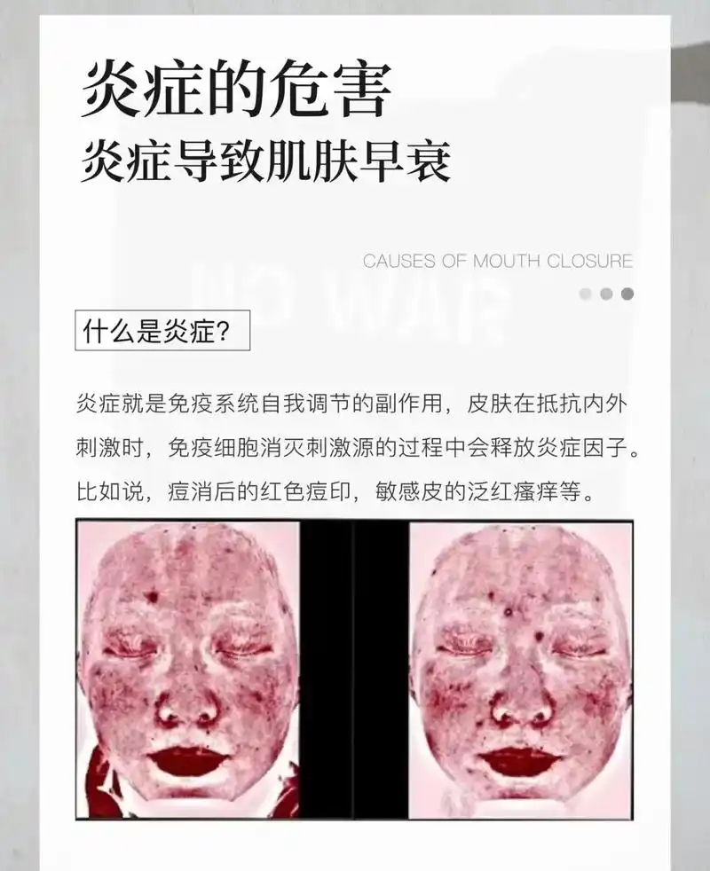 告别肌肤问题轻松拥有好皮肤 #护肤小知识 #相信专业决心美 - 抖音