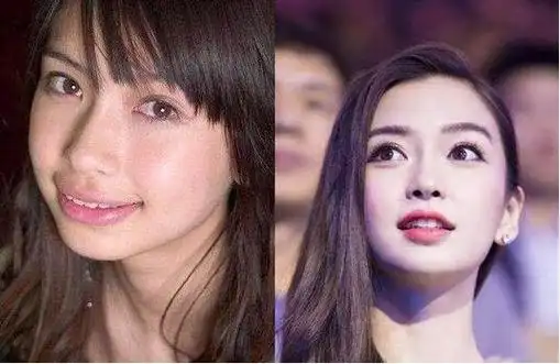 angelababy整容前后照片对比颜值遗传了父母