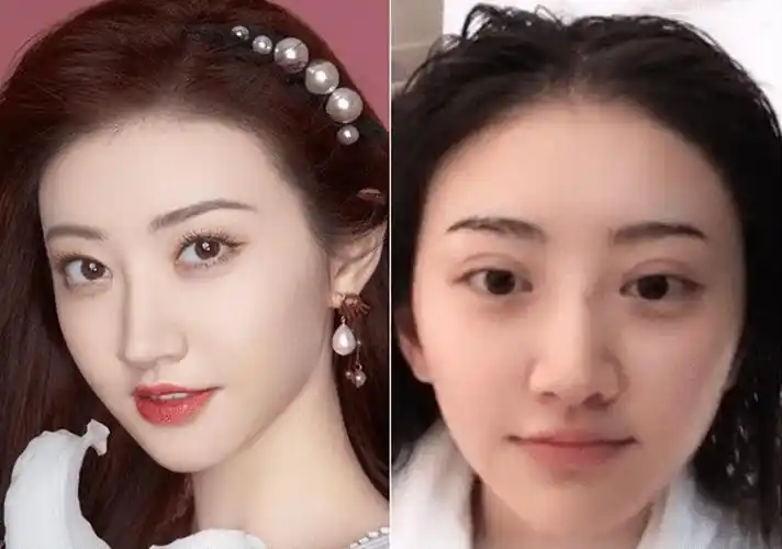 下垂眼的明星新闻_双眼皮别乱割,从白鹿到戚薇,这8位明星的"后遗症"都