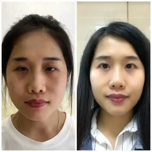 再来活生生的对比一下 真的人丑皮肤不好 选对好的产品来改善 那你就