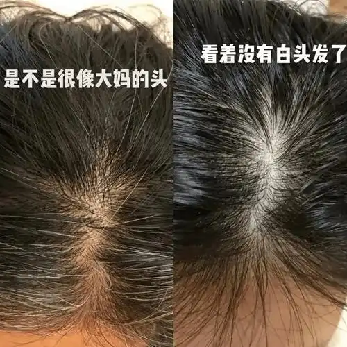 何首乌洗发水连用一个月,头发变黑变亮了,公司同事都让她帮忙带2瓶!