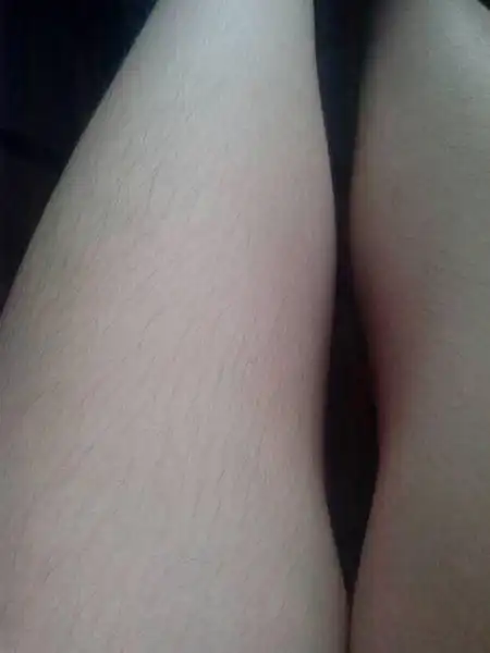 女生全身长毛怎么办女生身体上多毛怎么回事