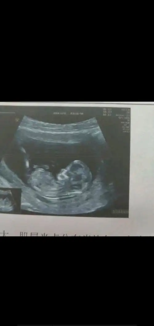 你2020年3月是的,但是能儿女双全最好|7539_9808:男宝女宝健康就好!