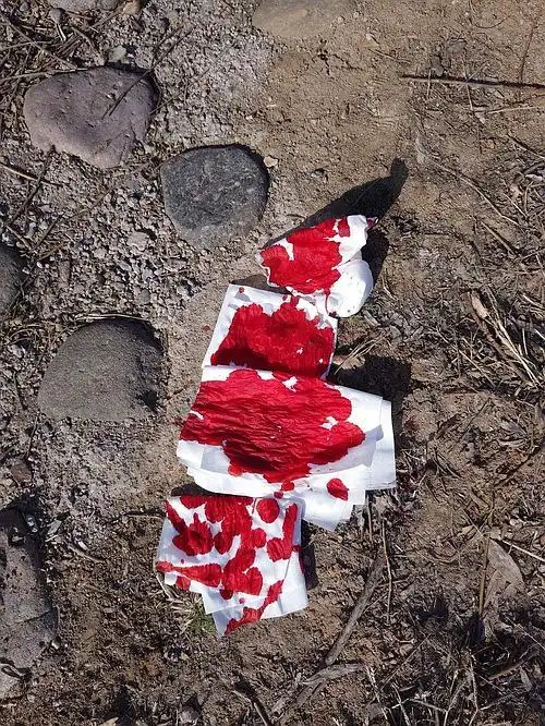 我了个妈呀!嘴上很小一个伤口为什么流血流成这样.