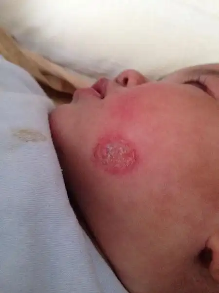 有谁知道这属于什么皮肤问